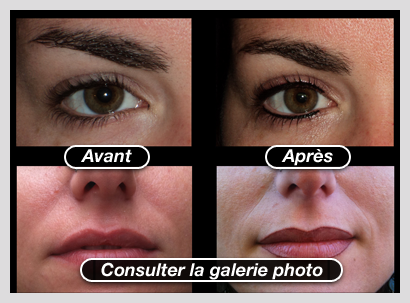 Consulter la galerie photo